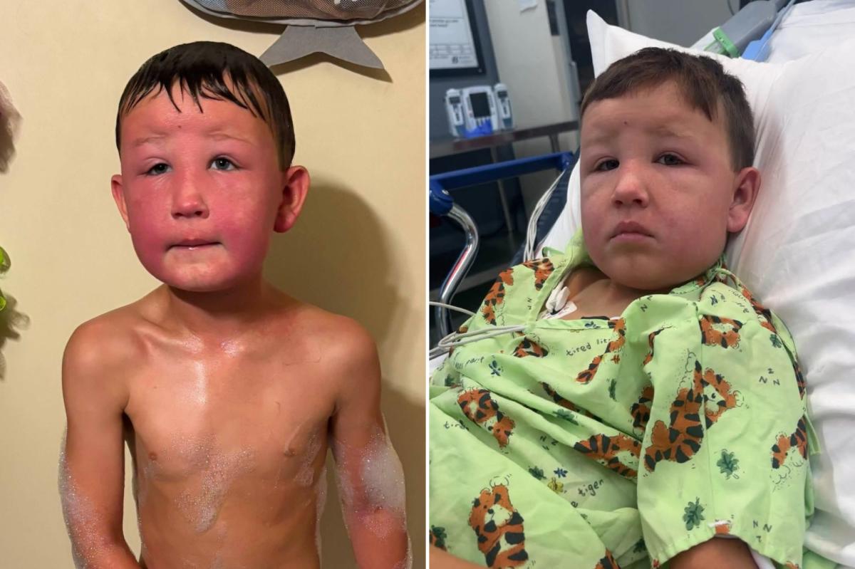 Illinois Boy's Brush with Death: The Poisonous Weed That Almost Took His Life