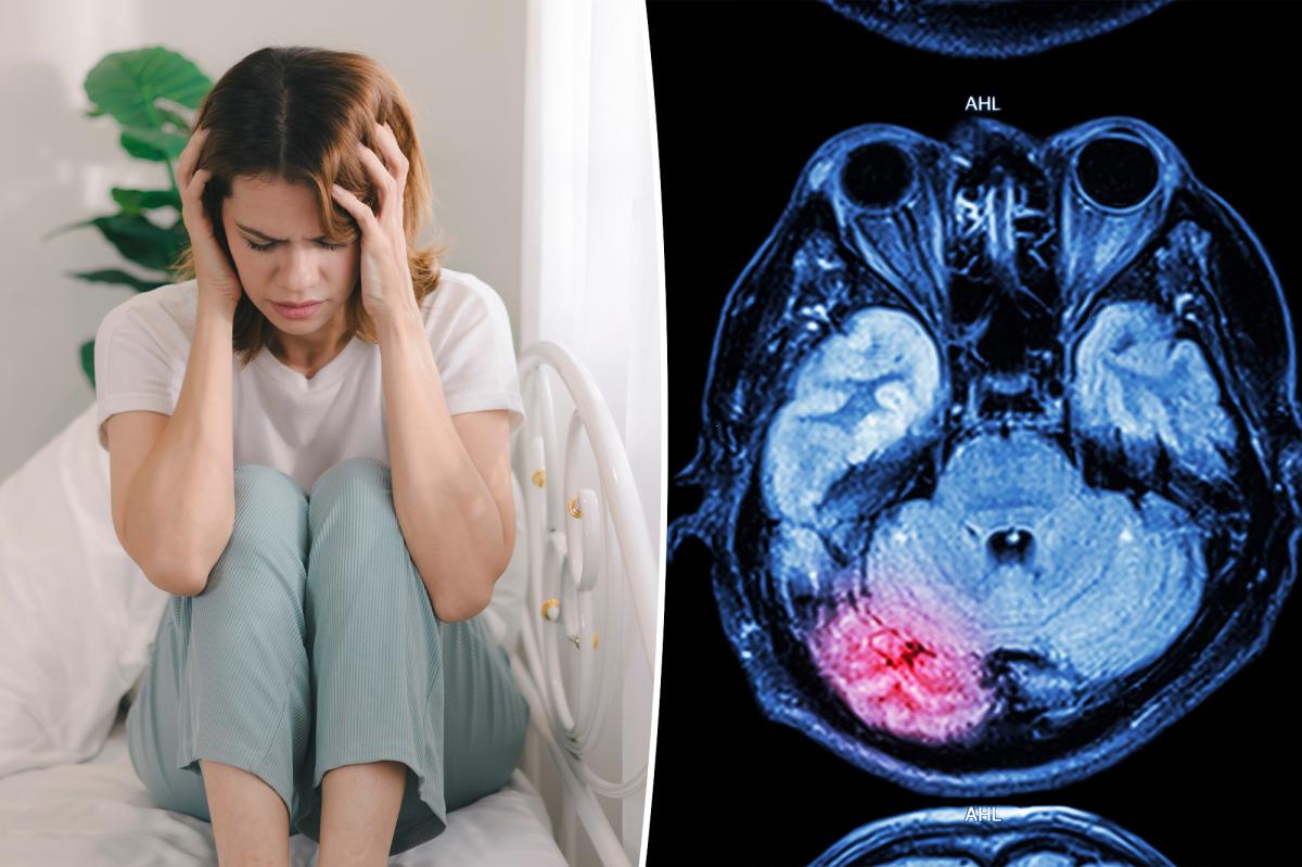 Why Stroke Rates Among Young Adults Are Surging