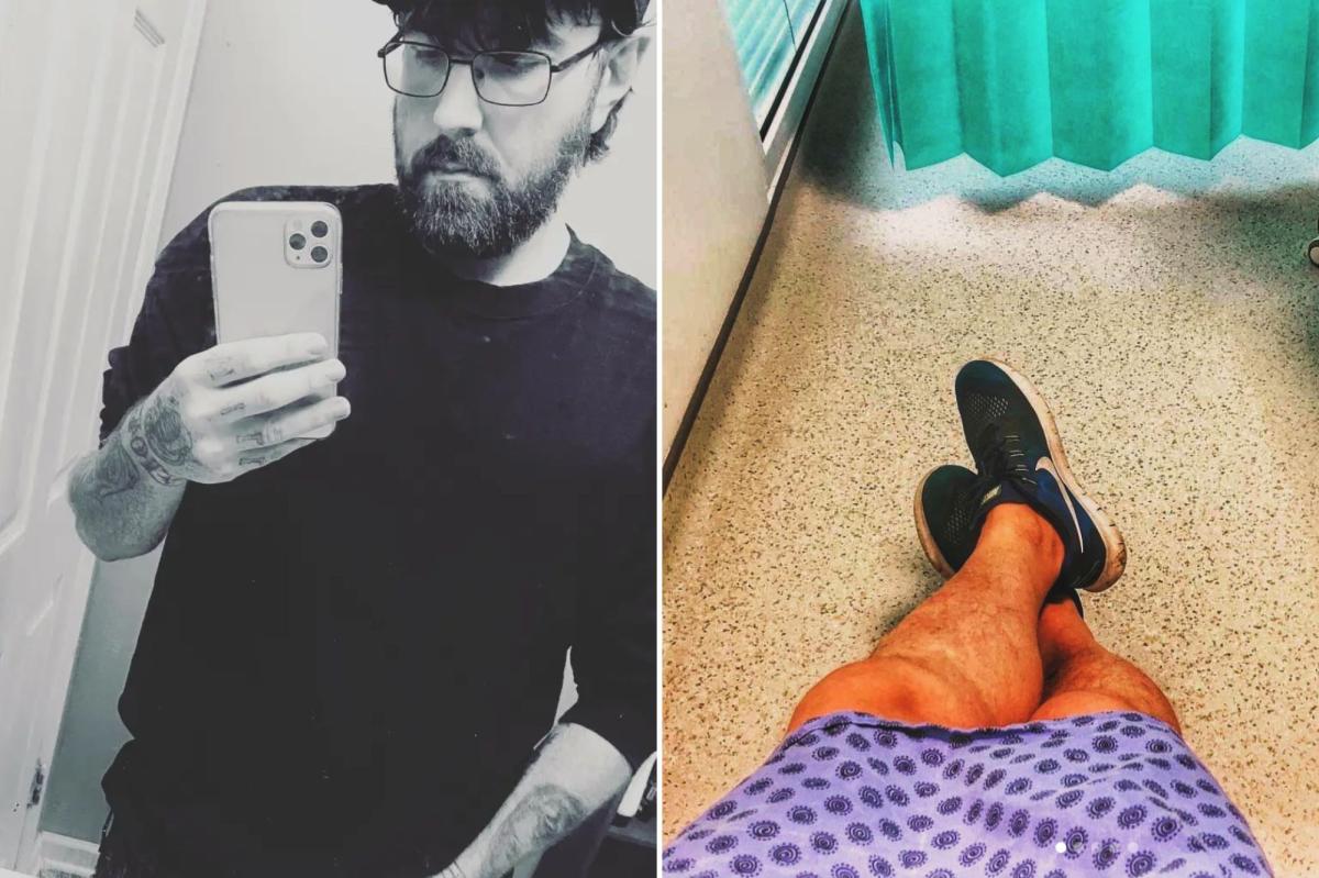 Michael Phillips' Micropenis Journey: The Crowdfunding Campaign That's Changing His Life