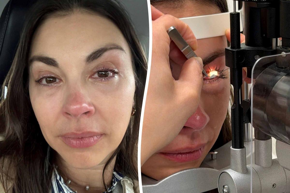 Mom's 20-Year Makeup Habit Leads to Shocking Eye Condition