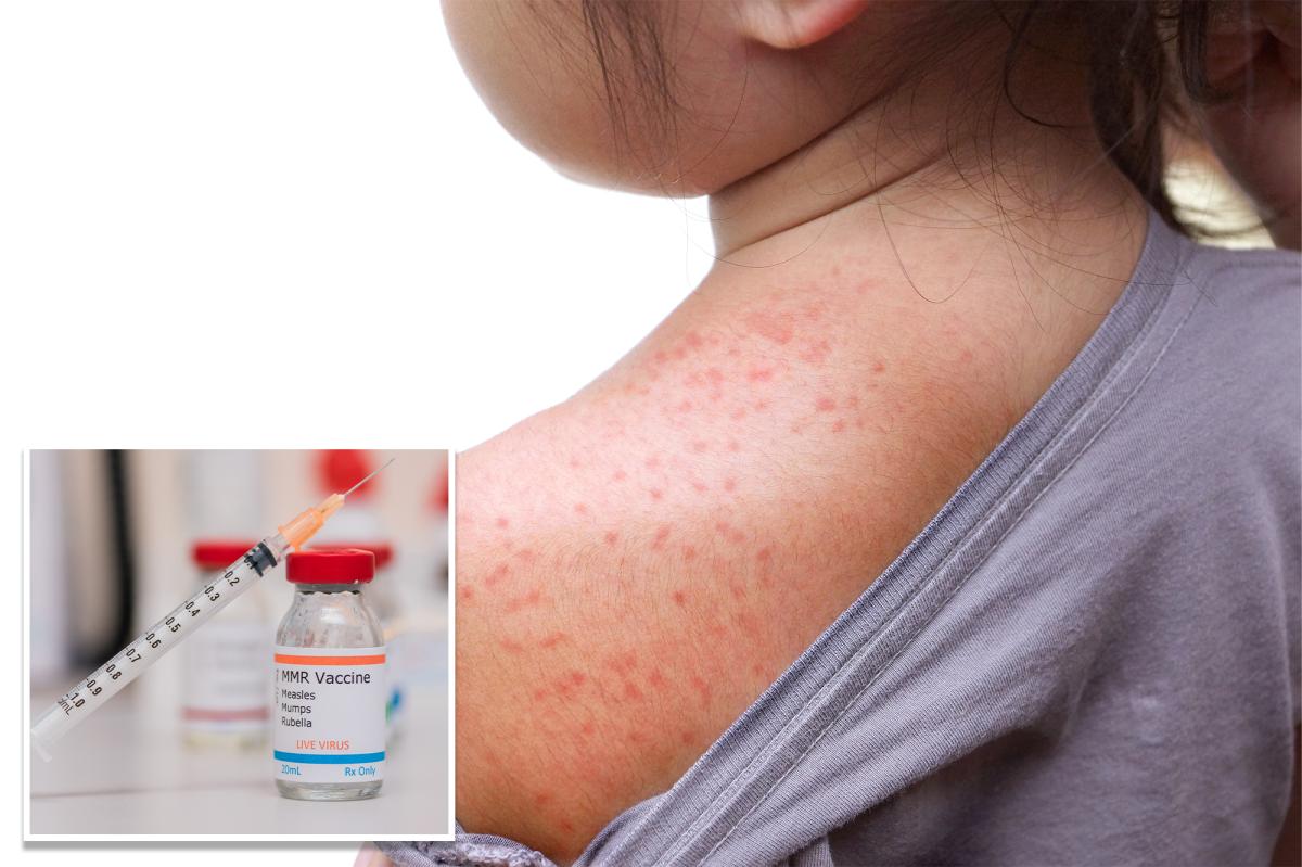 New York's Measles Outbreak: Why Governor Hochul Declared a State Emergency