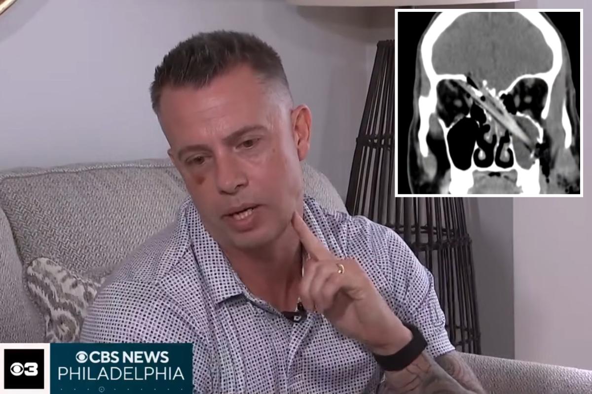New Jersey Father's Jaw-Dropping Survival After Tree Branch Impales His Brain